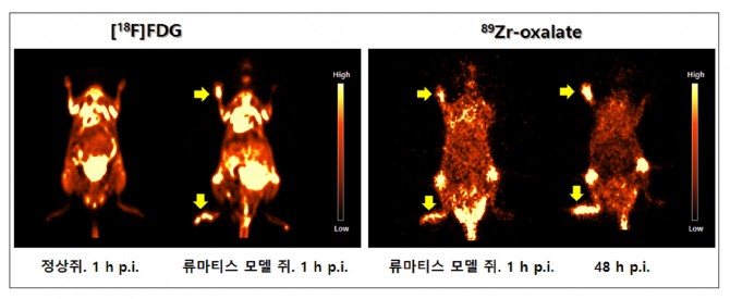 기존 조영제를 사용했을 때는 희미하게 보이던(왼쪽) 류마티스 관절염 부위가 새 조영제를 썼을 땐 뚜렷하게 보인다. - 한국원자력의학원 제공
